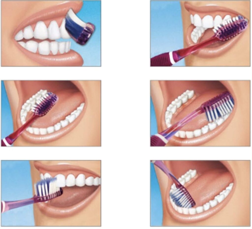 oral care measures brushing techniques