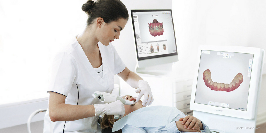 intra oral scanning for clear aligner